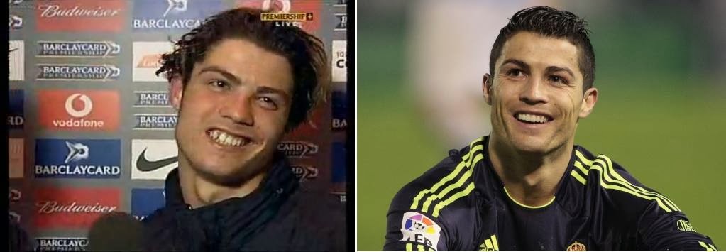 Cristiano Ronaldo antes y despues